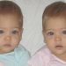 Tvillingerne blev for 8 år siden kaldt for verdens smukkeste - se nu hvordan pigerne ser ud i dag